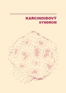 Karcinoidový syndrom, informace pro pacienty