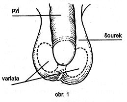 obr. 1
