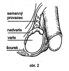 obr. 2