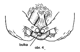 obr. 4