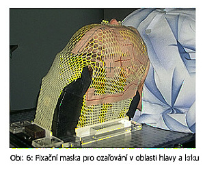 Fixační maska pro ozařování v oblasti hlavy a krku