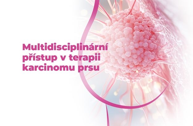 Multidisciplinární přístup v terapii karcinomu prsu