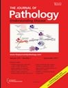 Journal of Pathology