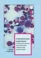 Vysokodávkovaná chemoterapie s transplantací kmenových krvetvorných buněk v komplexní léčbě zhoubných nádorů