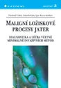 Maligní ložiskové procesy jater. Diagnostika a léčba včetně minimálně invazivních metod