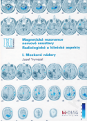 Magnetická rezonance nervové soustavy - radiologické a klinické aspekty I. Mozkové nádory