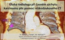 Role radiologa v programu časného záchytu karcinomu plic