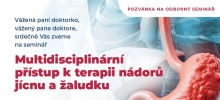 Multidisciplinární přístup k terapii nádorů jícnu a žaludku, 5. 11. 2025 v Hradci Králové