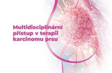 Multidisciplinární přístup v terapii karcinomu prsu 10. 6. 2026 v Hradci Králové