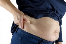 STANOVISKO České onkologické společnosti ČLS JEP k léčbě obezity v primární a terciární onkologické prevenci