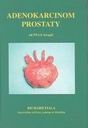 Adenokarcinom prostaty : od PSA k terapii