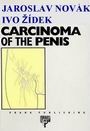 Carcinoma of the penis