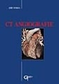 CT angiografie