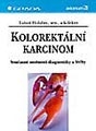 Kolorektální karcinom - Současné možnosti diagnostiky a léčby
