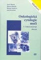 Onkologická cytologie moči v urologické praxi