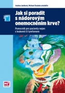 Jak si poradit s nádorovým onemocněním krve? 