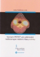 Význam PET/CT pro plánování radioterapie nádorů hlavy a krku