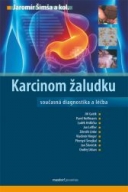 Karcinom žaludku. Současná diagnostika a léčba