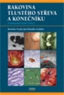 Rakovina tlustého střeva a konečníku