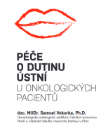 Péče o dutinu ústní u onkologických pacientů