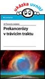 Prekancerózy v trávicím traktu