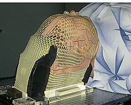 Fixační maska pro ozařování v oblasti hlavy a krku