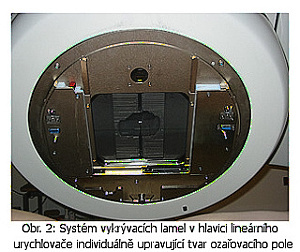Systém vykrývacích lamel v hlavici lineárního urychlovače individuálně upravující tvar ozařovacího pole