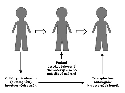 Schéma autologní transplantace