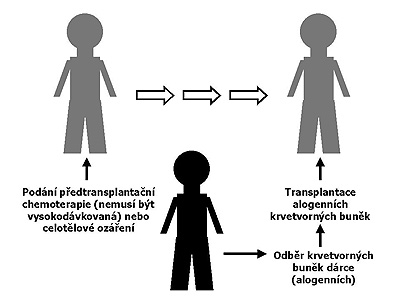 Schéma alogenní transplantace